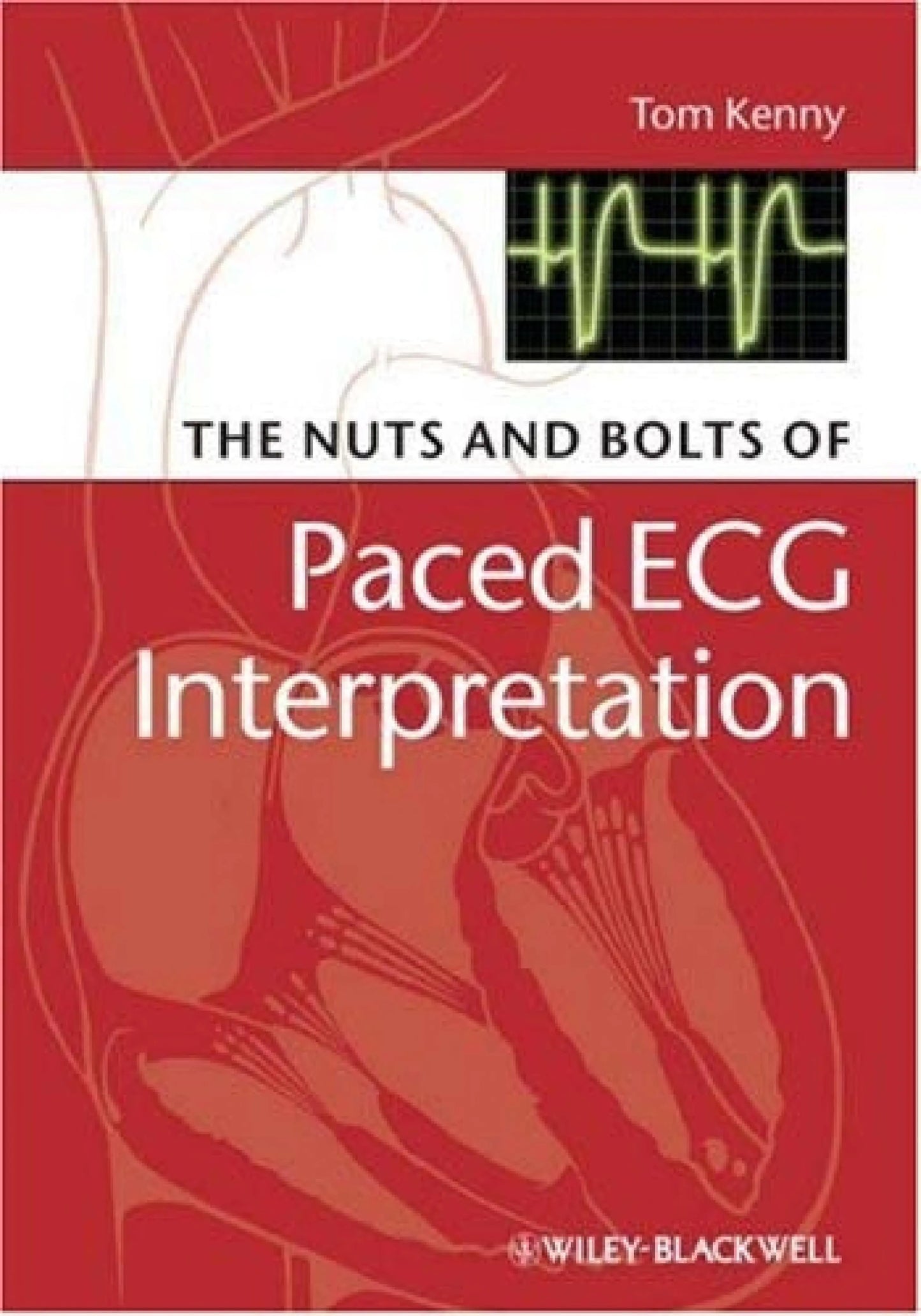 The Nuts and bolts of Paced ECG Interpretation by Tom Kenny – book cover
