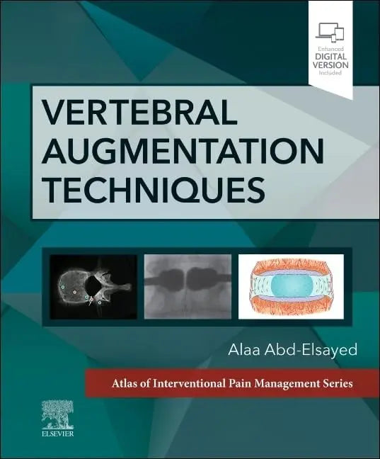 Vertebral Augmentation Techniques by Alaa Abd-Elsayed – book cover