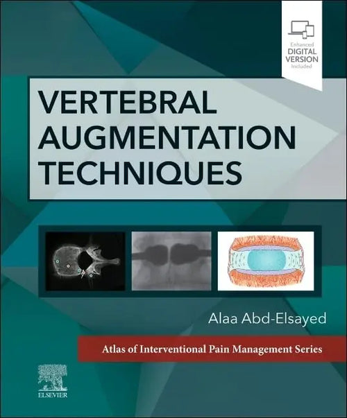 Vertebral Augmentation Techniques by Alaa Abd-Elsayed