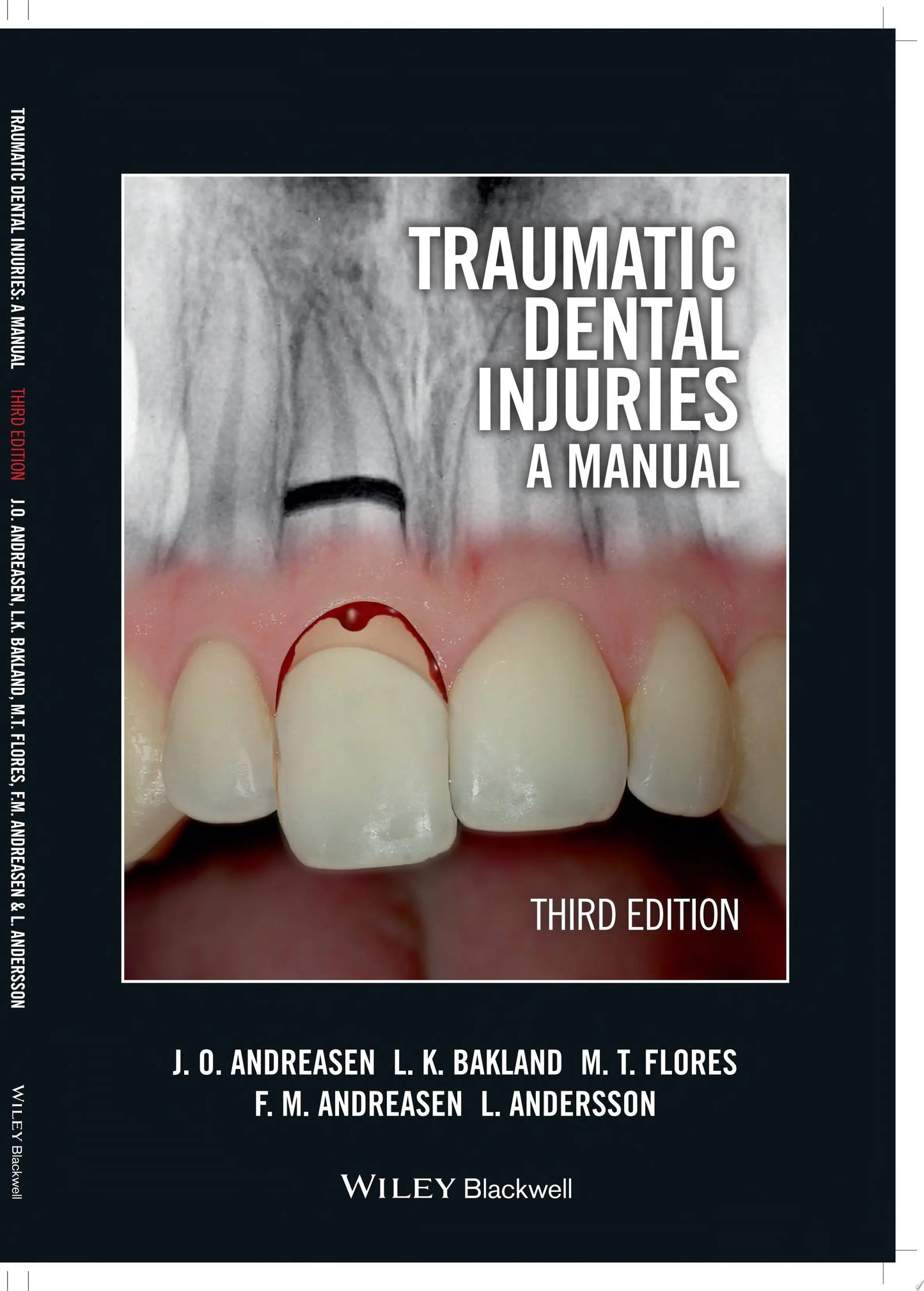 Traumatic Dental Injuries A Manual by Jens O. Andreasen – book cover