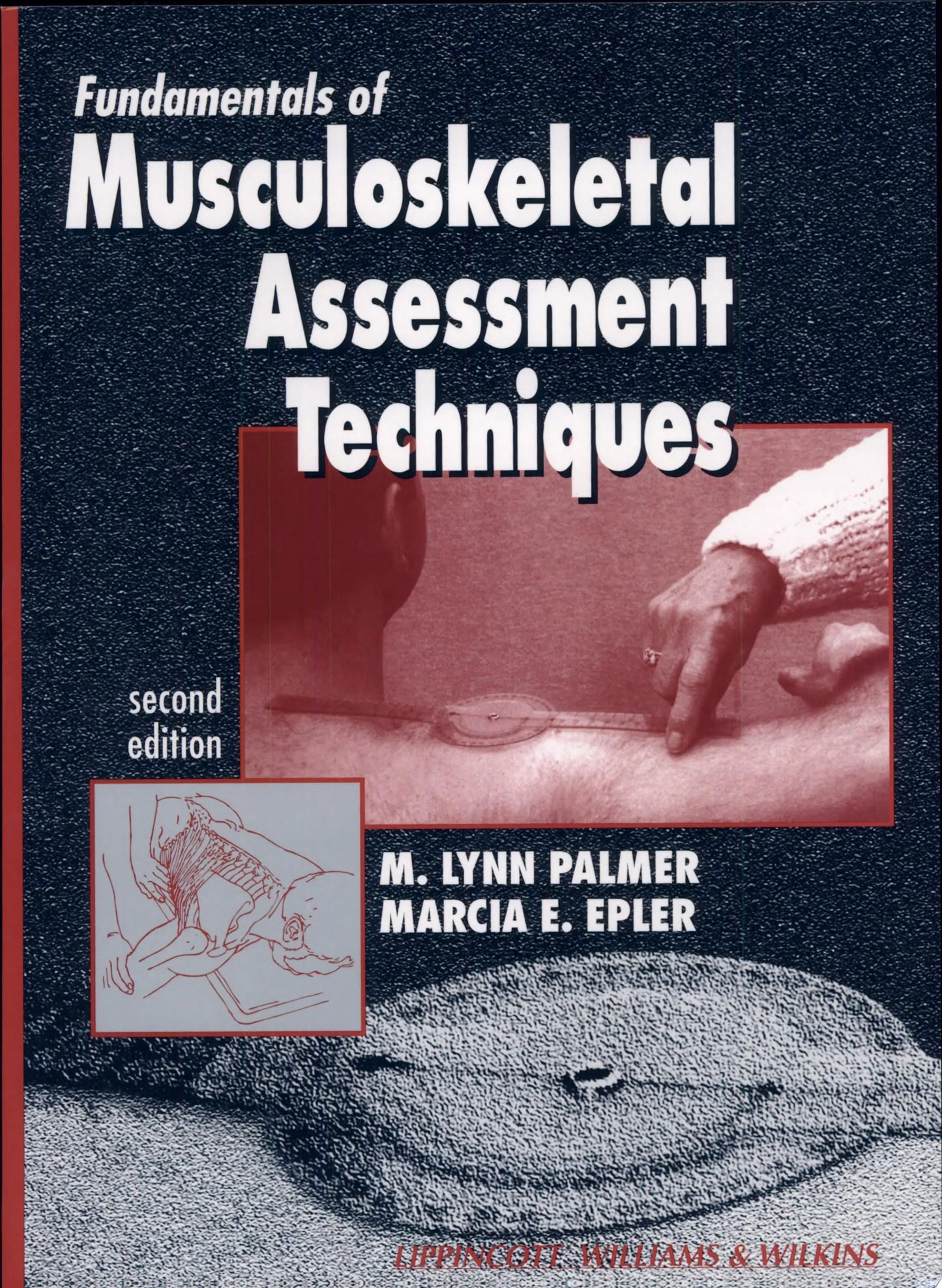 Fundamentals of Musculoskeletal Assessment Techniques by M. Lynn Palmer – book cover