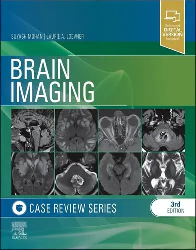 Brain Imaging Case Review Series Elsevier