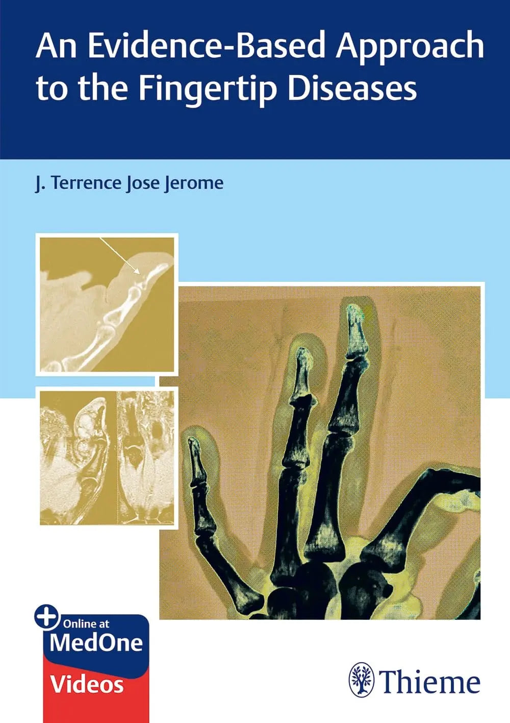 An Evidence-Based Approach to the Fingertip Diseases by J. Terrence Jerome – book cover