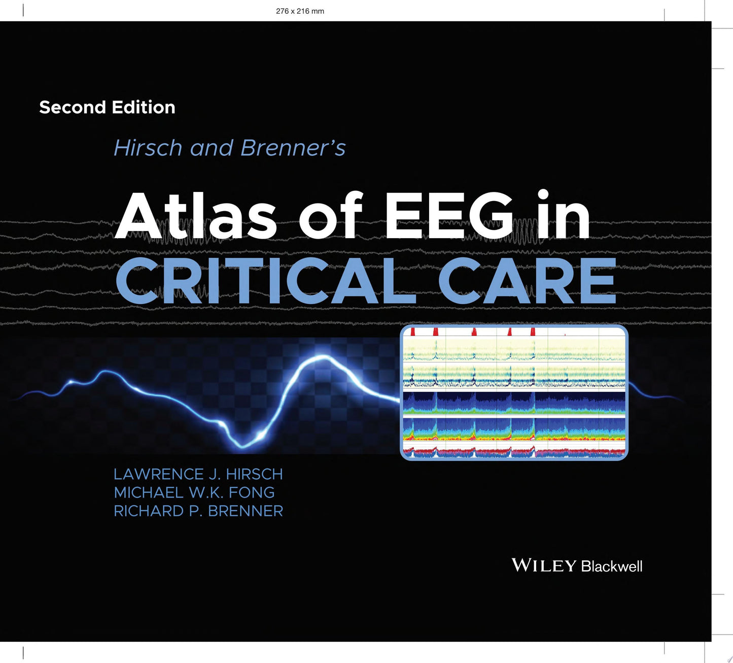 Hirsch and Brenner's Atlas of EEG in Critical Care John Wiley & Sons