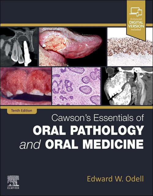 Cawson's Essentials of Oral Pathology and Oral Medicine by E. W. Odell