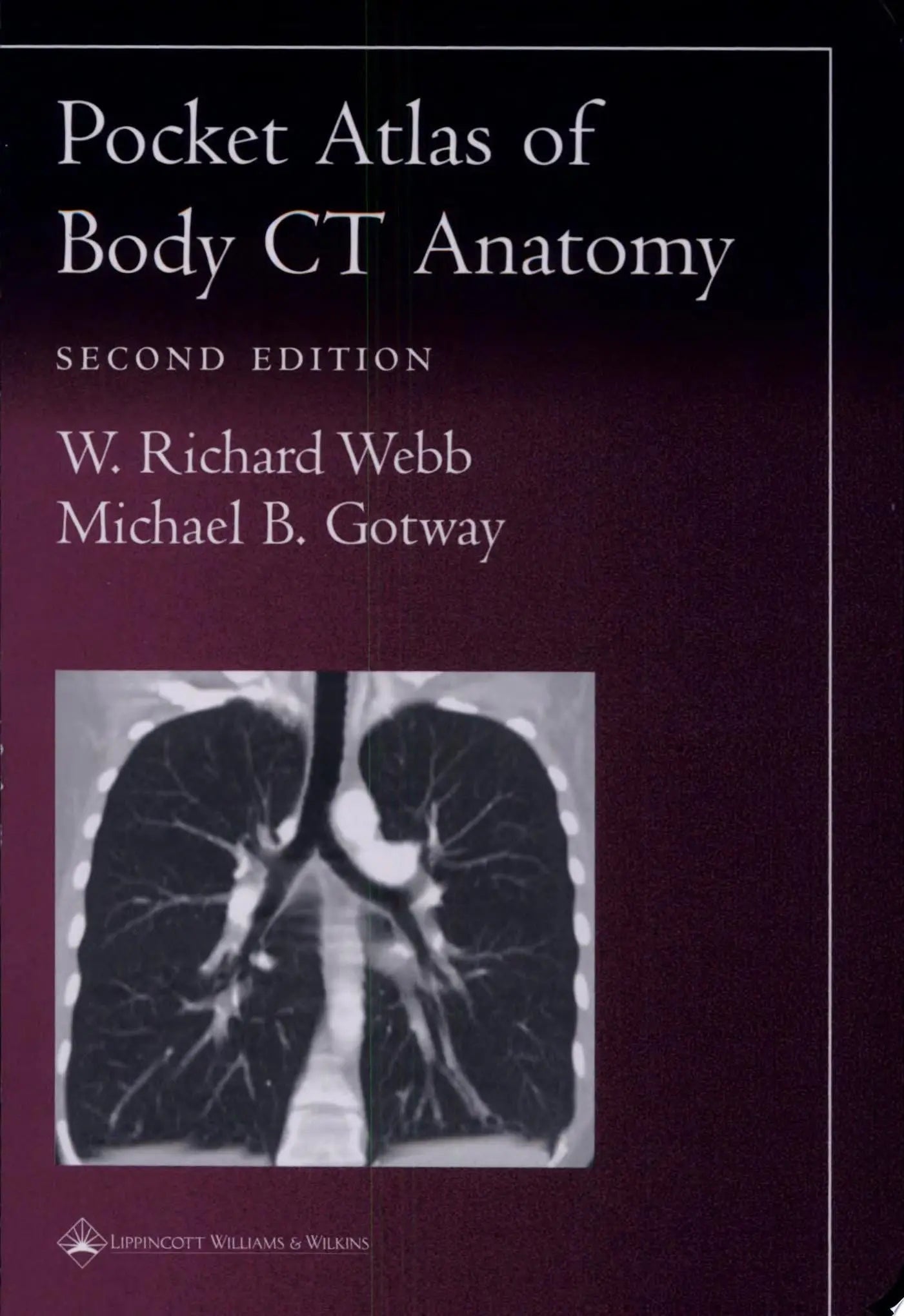 Pocket Atlas of Body CT Anatomy by W. Richard Webb – book cover