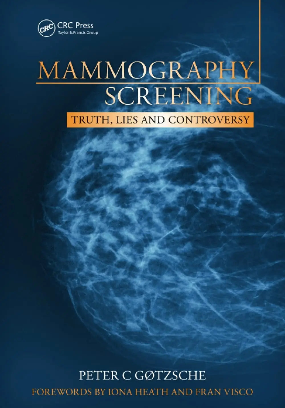 Mammography Screening Truth, Lies and Controversy by Peter C. Gøtzsche – book cover