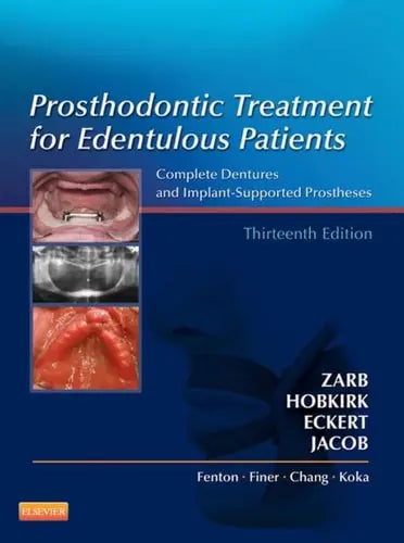 Prosthodontic Treatment for Edentulous Patients Complete Dentures and Implant-supported Prostheses Elsevier Mosby