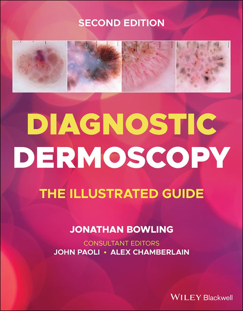 Diagnostic Dermoscopy The Illustrated Guide