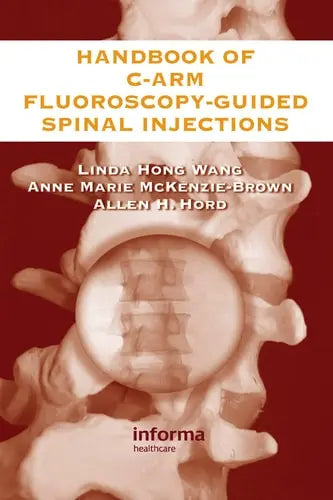 The Handbook of C-Arm Fluoroscopy-Guided Spinal Injections Taylor & Francis