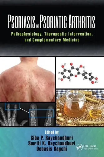 Psoriasis and Psoriatic Arthritis Pathophysiology, Therapeutic Intervention, and Complementary Medicine Taylor & Francis Group