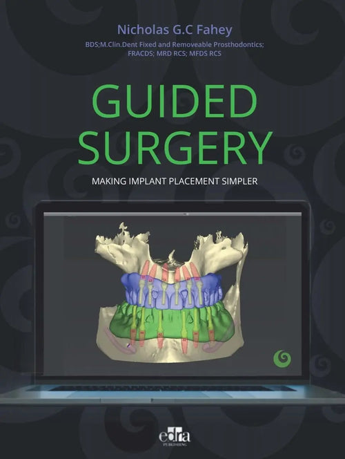 Guided Surgery. Making Implant Placement Simpler by Nicholas G.C. Fahey