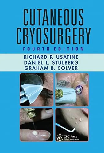 Cutaneous Cryosurgery Taylor & Francis Group