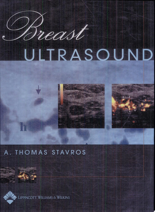 Breast Ultrasound by A. Thomas Stavros