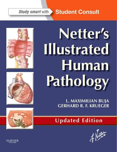 Netter's Illustrated Human Pathology Saunders/Elsevier