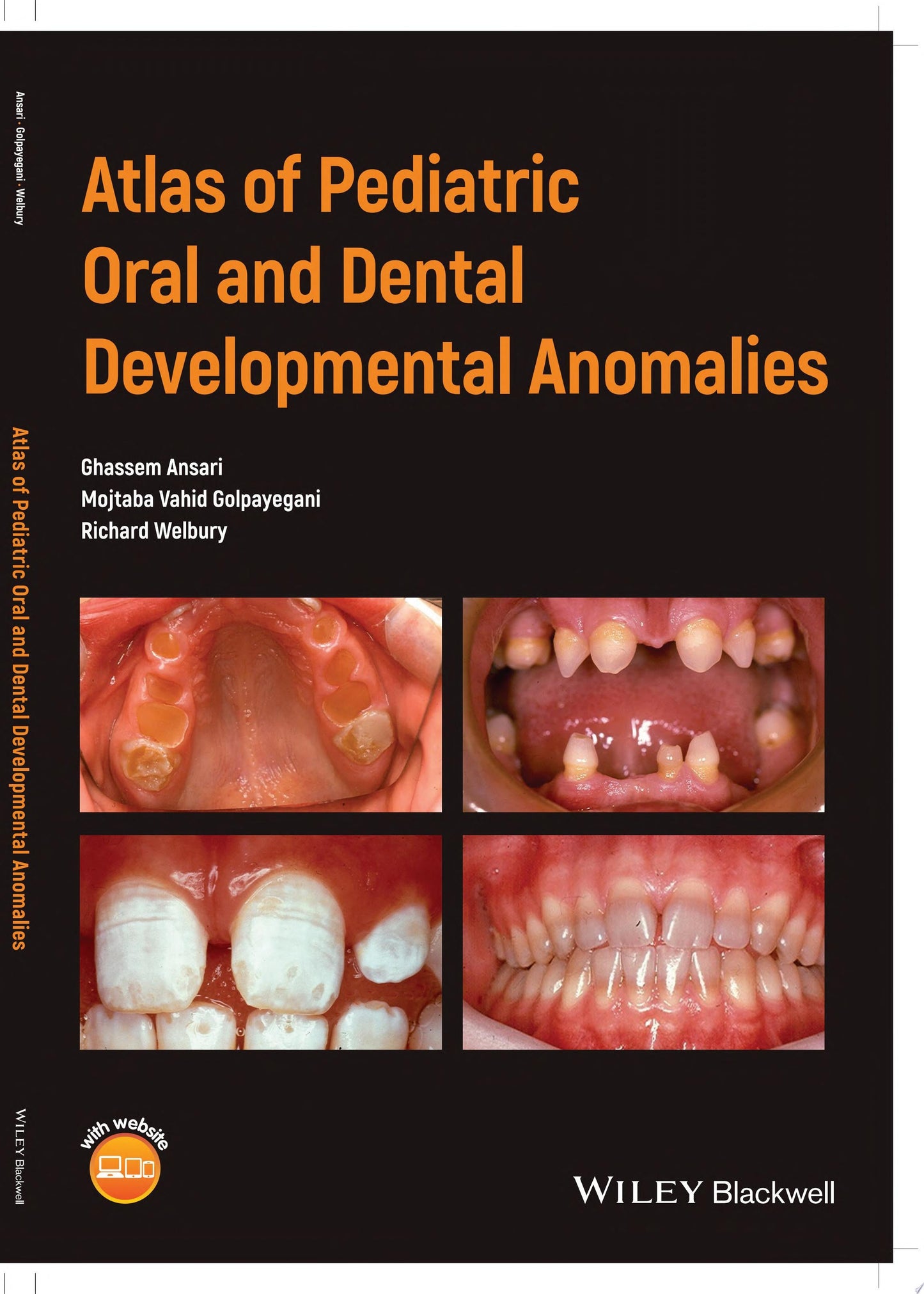 Atlas of Pediatric Oral and Dental Developmental Anomalies John Wiley & Sons