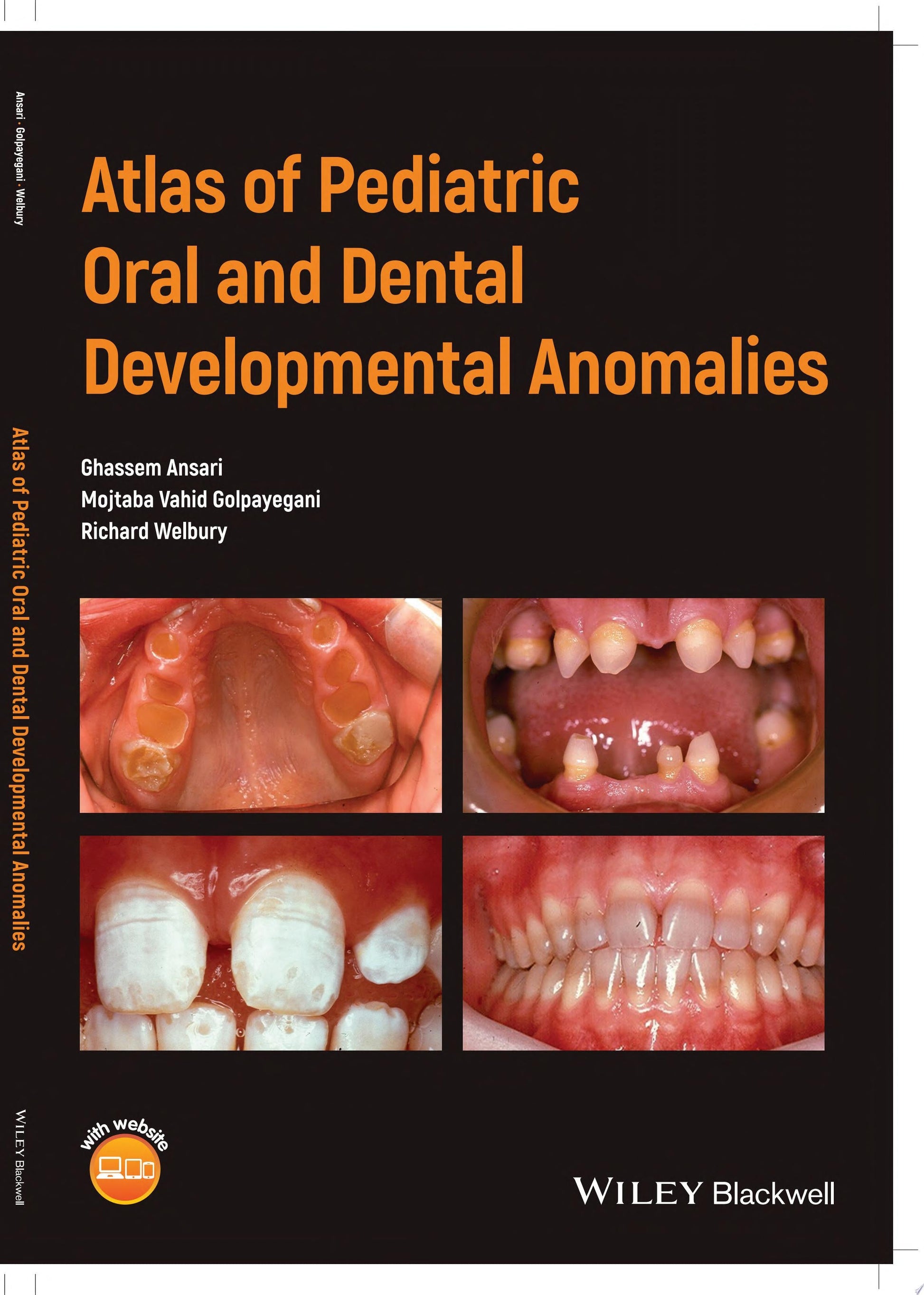 Atlas of Pediatric Oral and Dental Developmental Anomalies John Wiley & Sons