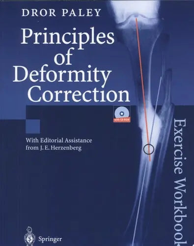 Principles of Deformity Correction Exercise Workbook Springer Science & Business Media
