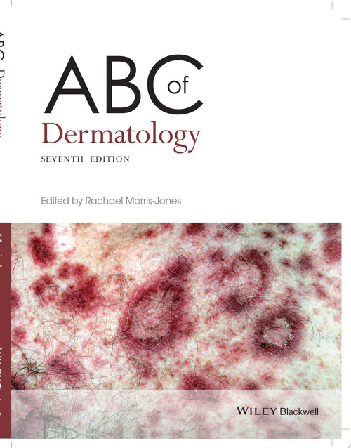 ABC of Dermatology