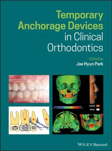 Temporary Anchorage Devices in Clinical Orthodontics John Wiley & Sons