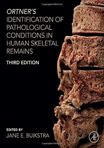 Ortner's Identification of Pathological Conditions in Human Skeletal Remains Elsevier Science
