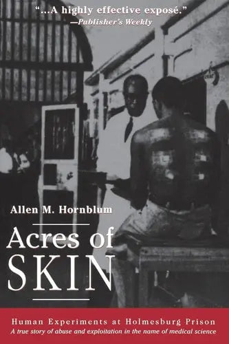 Acres of Skin Human Experiments at Holmesburg Prison : a True Story of Abuse and Exploitation in the Name of Medical Science Routledge