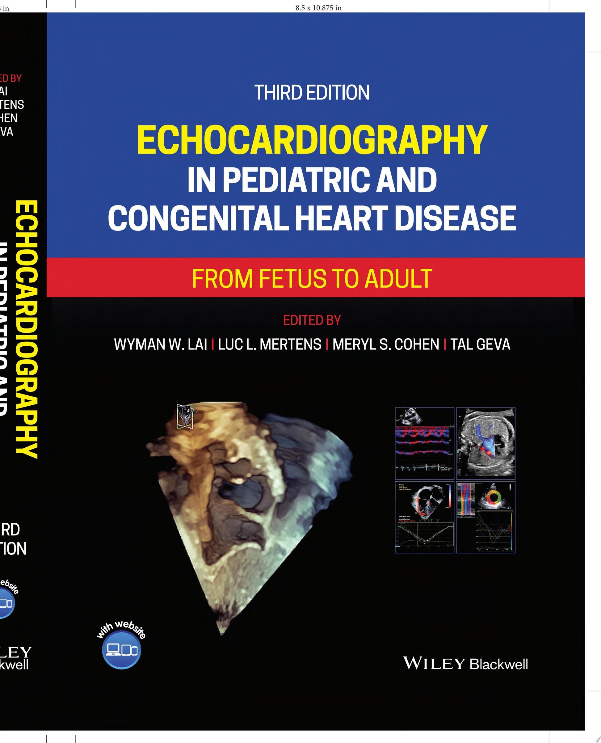 Echocardiography in Pediatric and Congenital Heart Disease From Fetus to Adult John Wiley & Sons