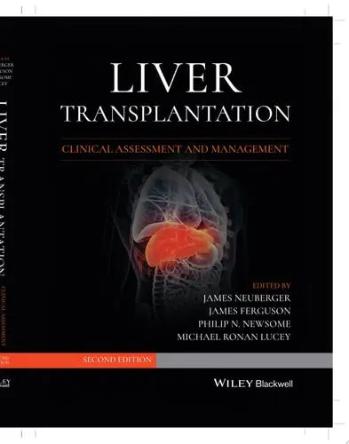 Liver Transplantation Clinical Assessment and Management – book cover