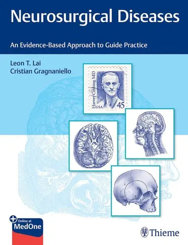 Neurosurgical Diseases An Evidence-Based Approach to Guide Practice Thieme