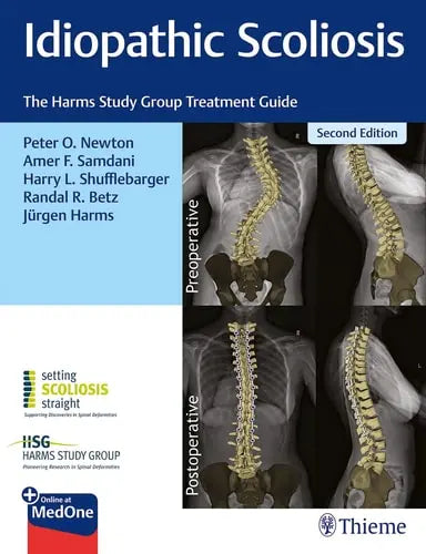 Idiopathic Scoliosis The Harms Study Group Treatment Guide Thieme Medical Publishers, Incorporated