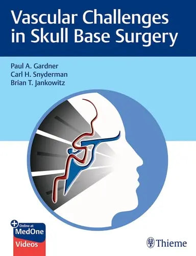 Vascular Challenges in Skull Base Surgery Thieme Medical Publishers, Incorporated