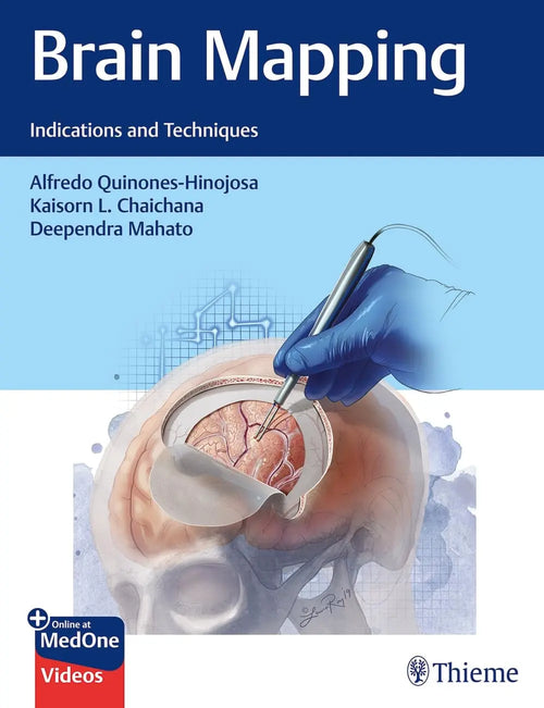 Brain Mapping Indications and Techniques by Alfredo Quinones-Hinojosa