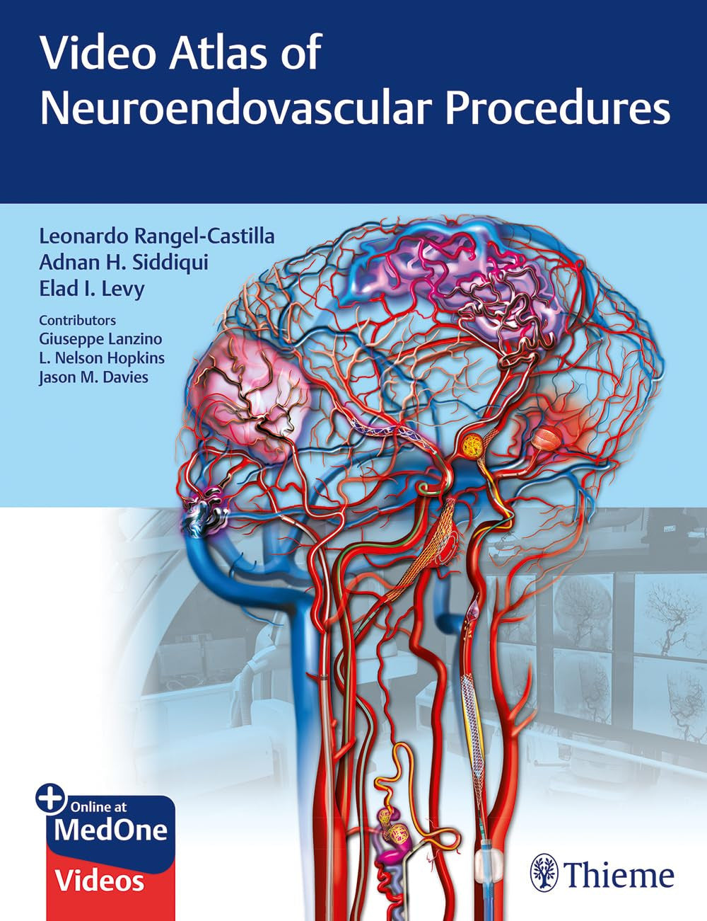 Video Atlas of Neuroendovascular Procedures Thieme