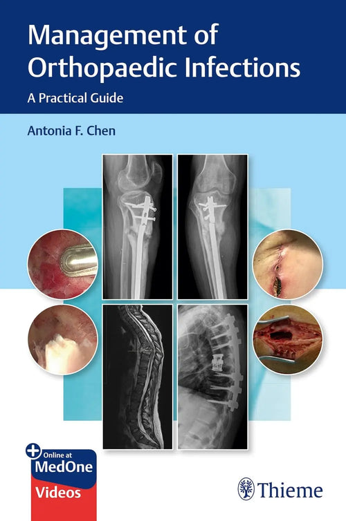Management of Orthopaedic Infections A Practical Guide by Antonia Chen
