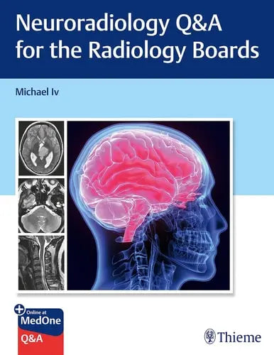 Neuroradiology Q&A for the Radiology Boards Thieme