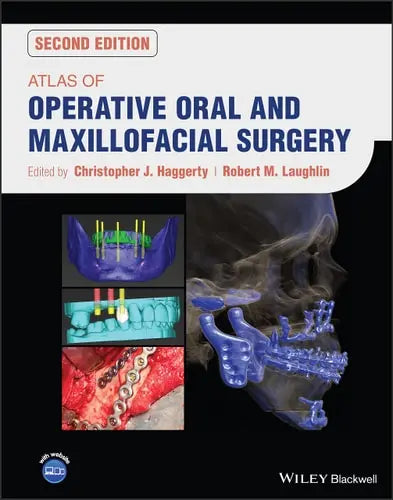 Atlas of Operative Oral and Maxillofacial Surgery Wiley