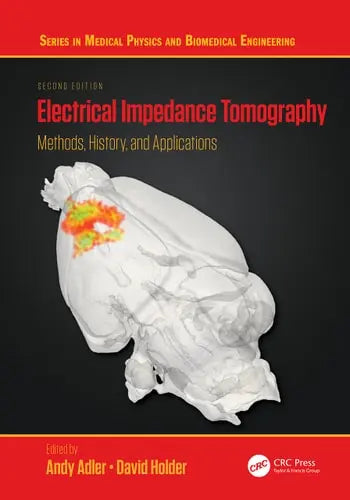Electrical Impedance Tomography Methods, History and Applications CRC Press