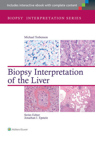 Biopsy Interpretation of the Liver by Michael S. Torbenson – book cover