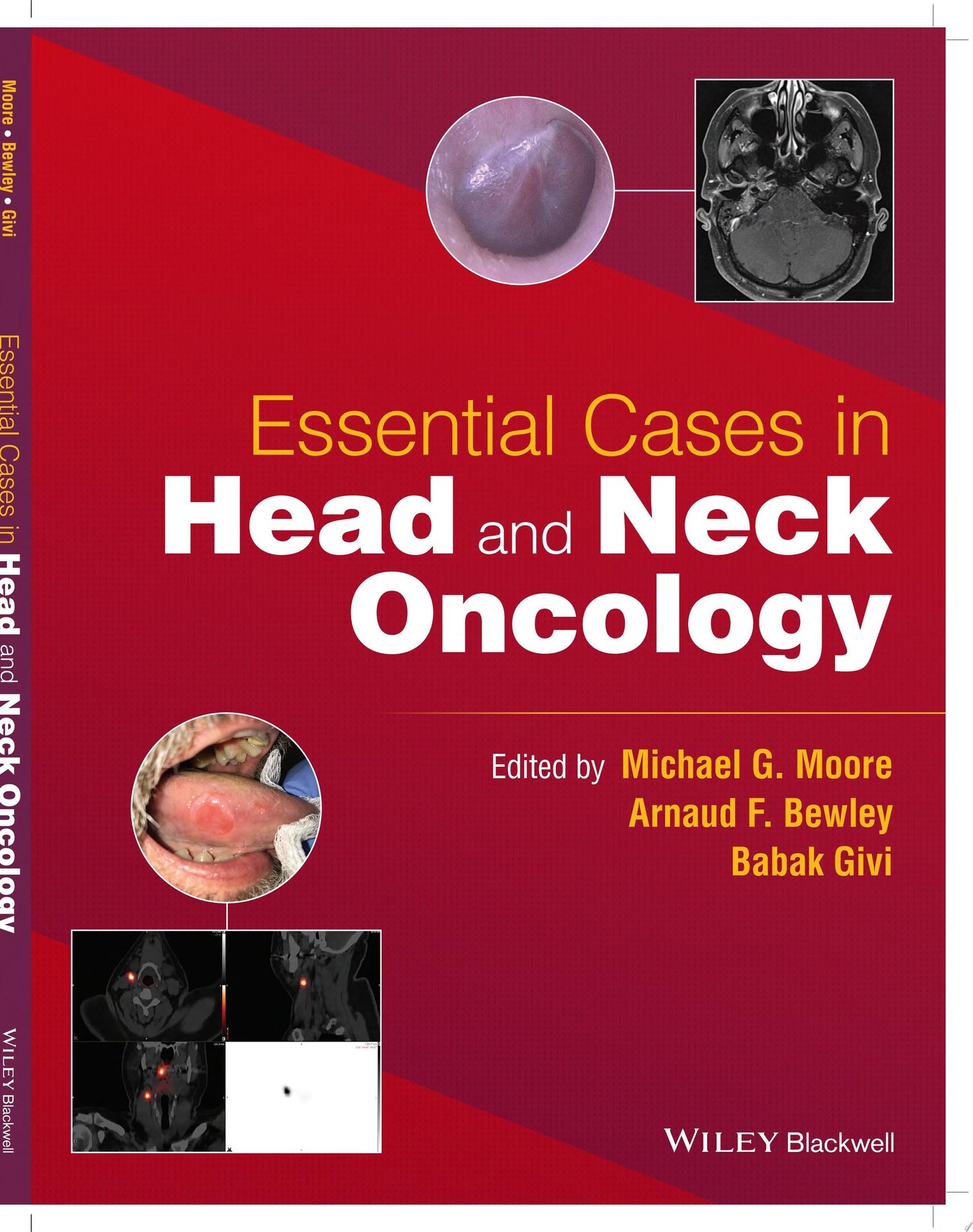 Essential Cases in Head and Neck Oncology John Wiley & Sons