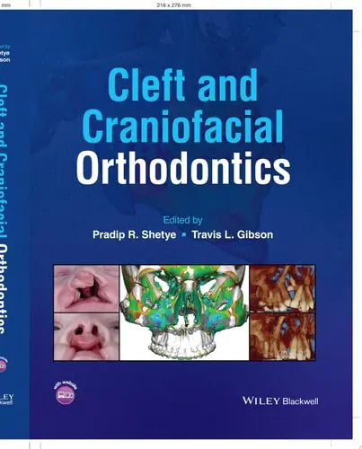 Cleft and Craniofacial Orthodontics by Pradip R. Shetye