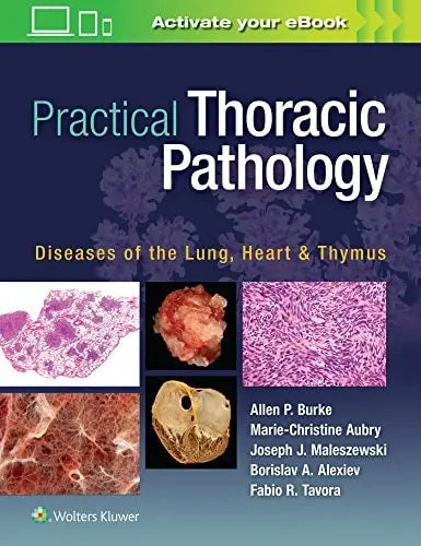 Practical Thoracic Pathology Diseases of the Lung, Heart, and Thymus by Allen Burke