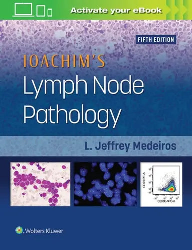 Ioachim's Lymph Node Pathology Wolters Kluwer