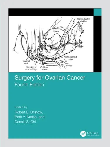 Surgery for Ovarian Cancer CRC Press