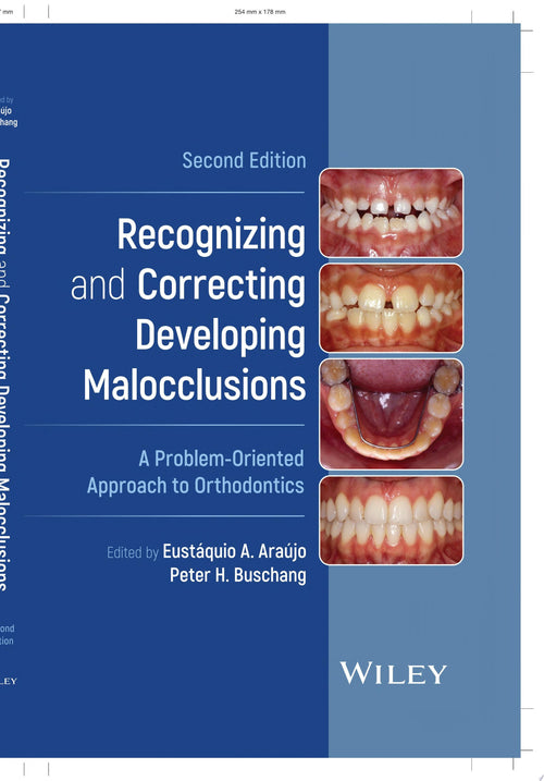 Recognizing and Correcting Developing Malocclusions A Problem-Oriented Approach to Orthodontics
