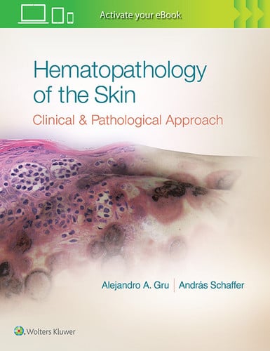 Hematopathology of the Skin Clinical and Pathological Approach by Alejandro Ariel Gru – book cover