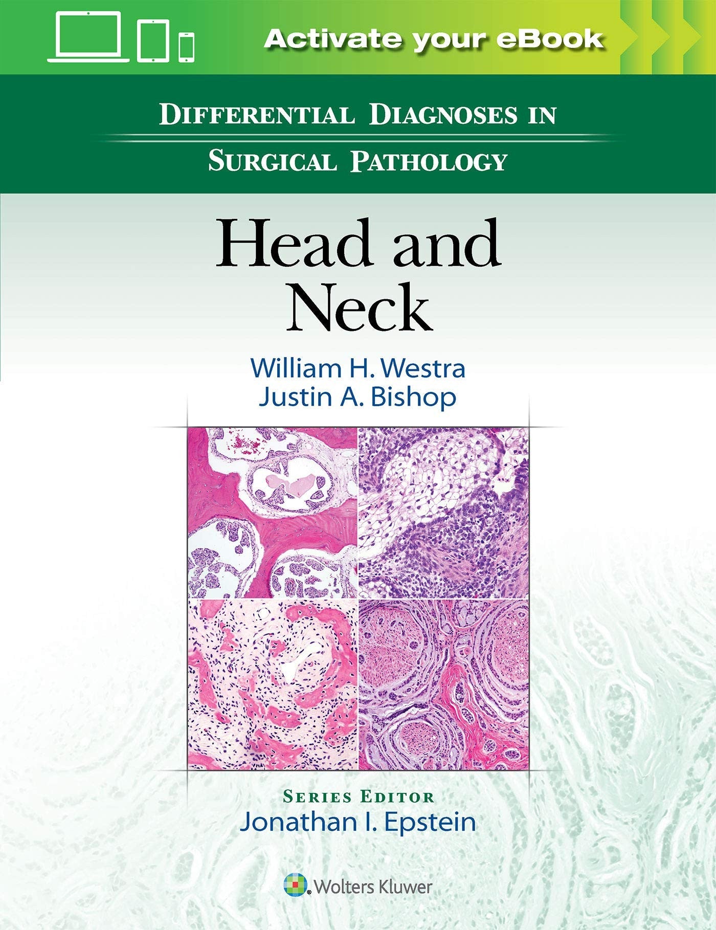 Differential Diagnoses in Surgical Pathology: Head and Neck Wolters Kluwer