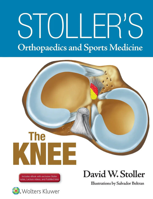 Stoller's Orthopaedics and Sports Medicine The knee by David W. Stoller