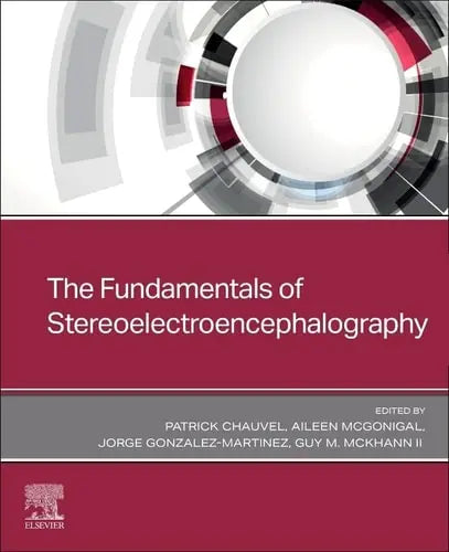 The Fundamentals of Stereoelectroencephalography Elsevier