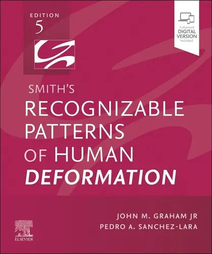 Smith's Recognizable Patterns of Human Deformation Elsevier