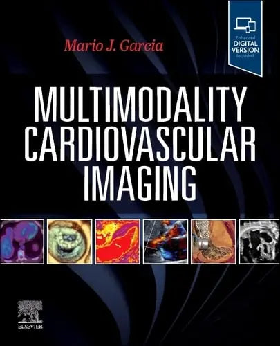 Multimodality Cardiovascular Imaging Elsevier